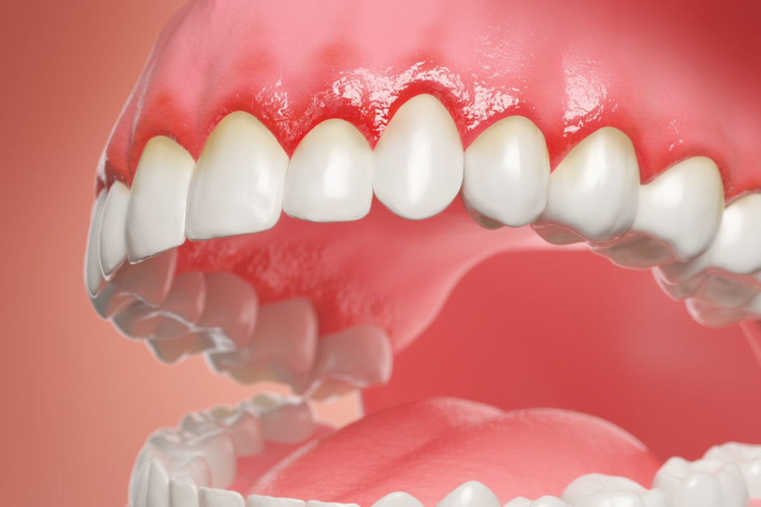 Prevention: Making Biofilm Visible Motivates Better Oral Health Habits