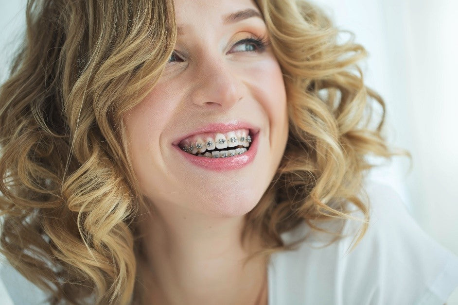 Clear Removable Aligners vs. Braces for Adults: Which is Right for You?