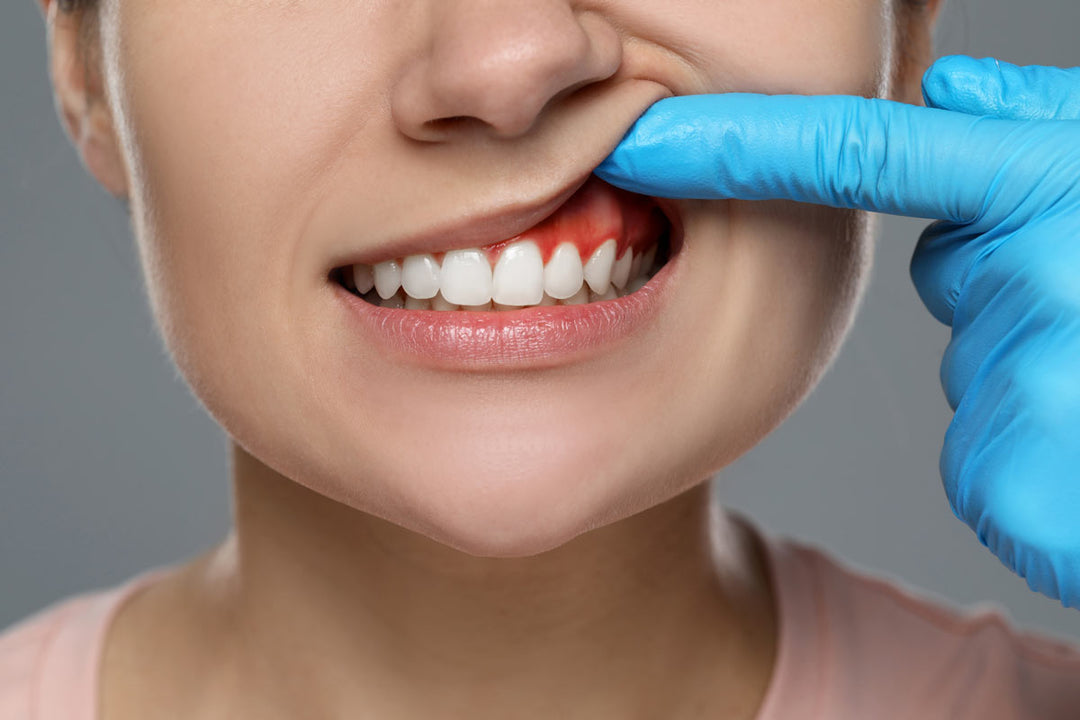 The Inflammatory Link: How Oral Health Reflects and Influences Systemic Wellness