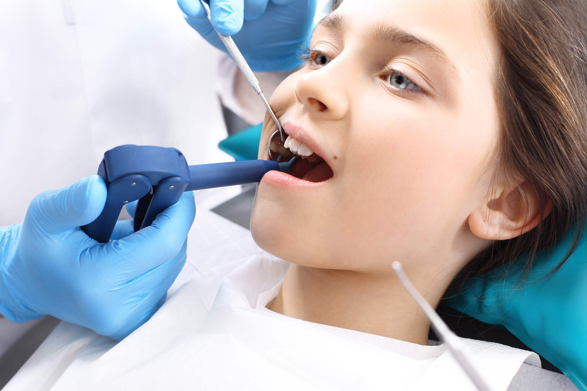 Does my child need dental sealants to prevent cavities? TePe Oral