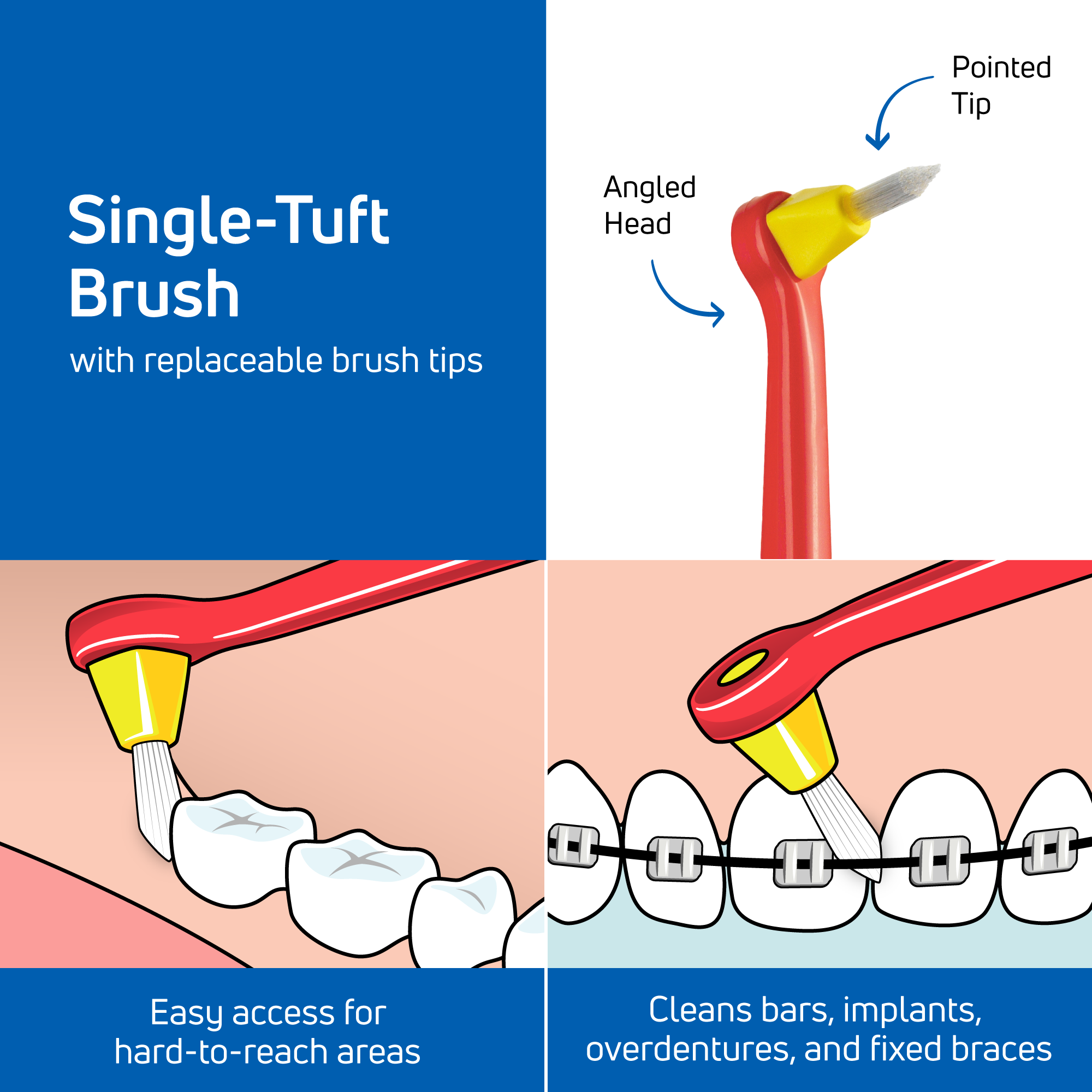 Angled Toothbrush TePe Interspace TePe Oral Health Care Inc Angled Toothbrush TePe Interspace TePe Oral Health Care Inc