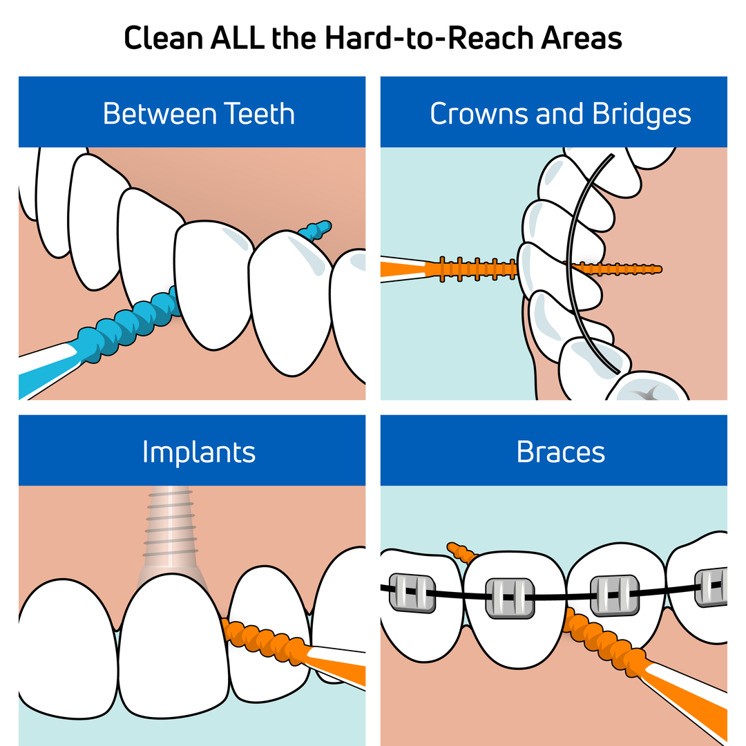 Tepe Method TePe EasyPick™ (M/L) – TePe Oral Health Care, Inc.